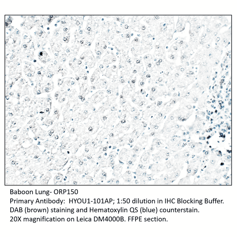Anti-ORP150 Antibody from FabGennix (HYOU1-101AP) - Antibodies.com
