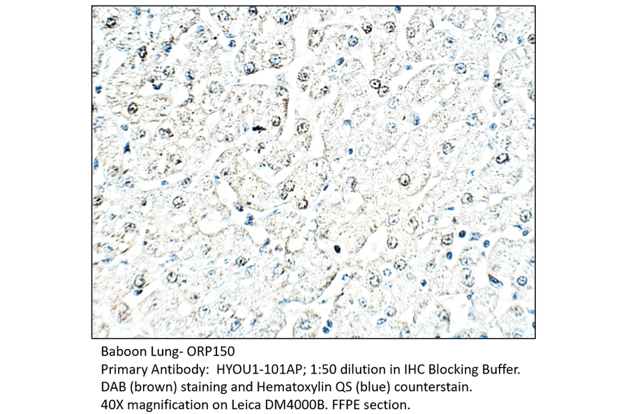Anti-ORP150 Antibody from FabGennix (HYOU1-101AP) - Antibodies.com