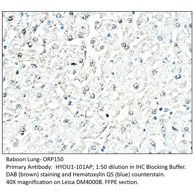 Anti-ORP150 Antibody from FabGennix (HYOU1-101AP) - Antibodies.com