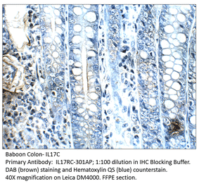 Anti-IL17C Antibody from FabGennix (IL17RC-301AP) - Antibodies.com