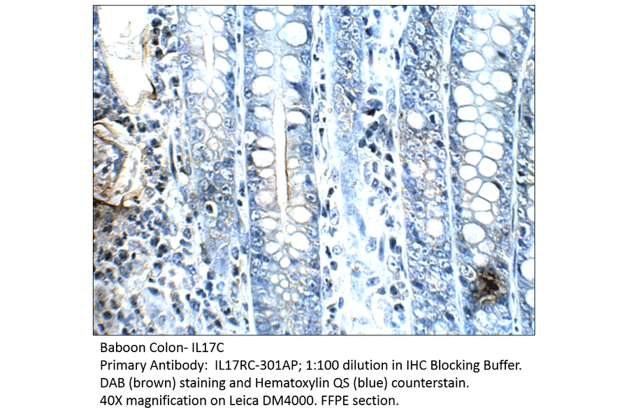 Anti-IL17C Antibody from FabGennix (IL17RC-301AP) - Antibodies.com