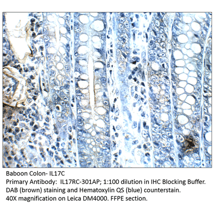 Anti-IL17C Antibody from FabGennix (IL17RC-301AP) - Antibodies.com