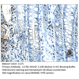 Anti-IL17C Antibody from FabGennix (IL17RC-301AP) - Antibodies.com