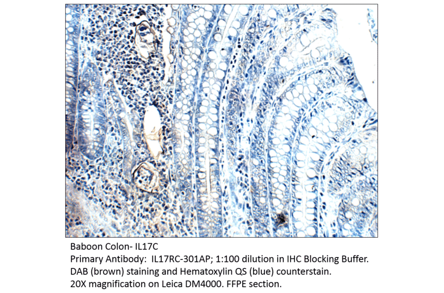 Anti-IL17C Antibody from FabGennix (IL17RC-301AP) - Antibodies.com