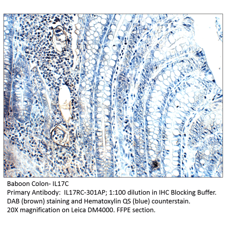 Anti-IL17C Antibody from FabGennix (IL17RC-301AP) - Antibodies.com