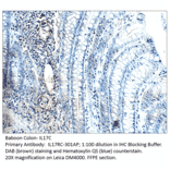 Anti-IL17C Antibody from FabGennix (IL17RC-301AP) - Antibodies.com