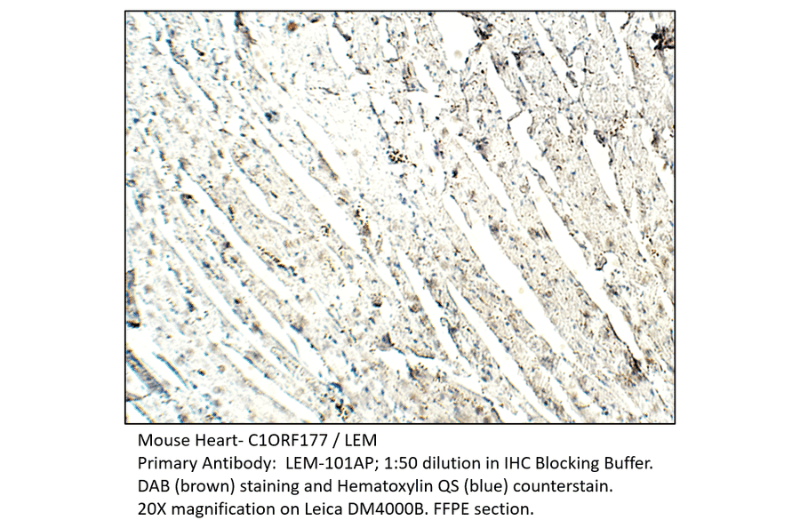 Anti-C1ORF177 Antibody from FabGennix (LEM-101AP) - Antibodies.com