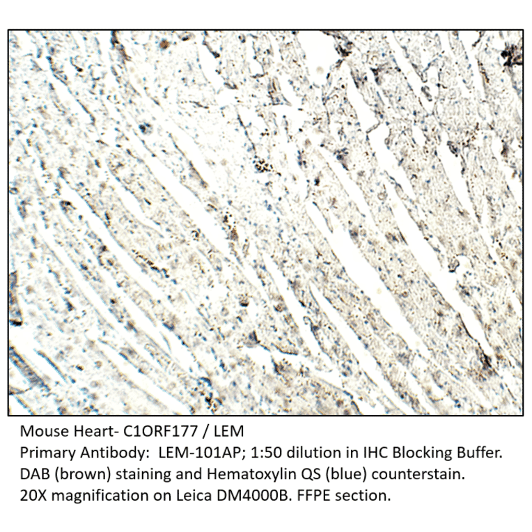 Anti-C1ORF177 Antibody from FabGennix (LEM-101AP) - Antibodies.com