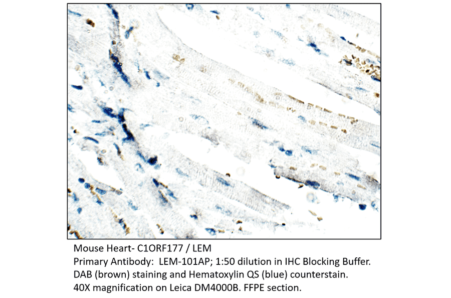 Anti-C1ORF177 Antibody from FabGennix (LEM-101AP) - Antibodies.com