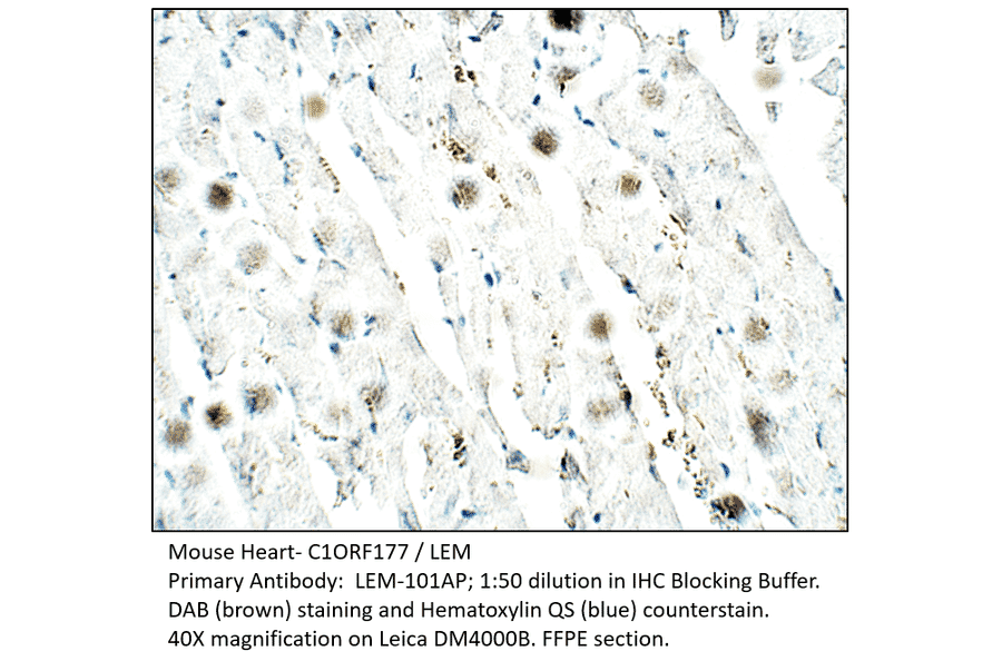 Anti-C1ORF177 Antibody from FabGennix (LEM-101AP) - Antibodies.com