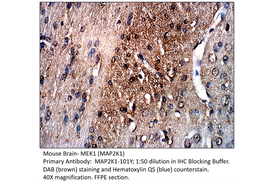 Anti-MAP2K1 Antibody from FabGennix (MAP2K1-101Y) - Antibodies.com