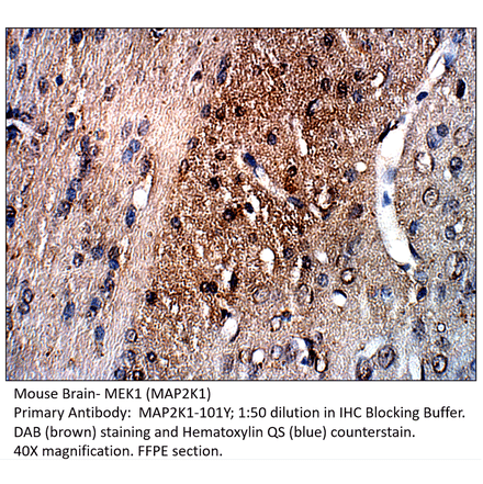 Anti-MAP2K1 Antibody from FabGennix (MAP2K1-101Y) - Antibodies.com