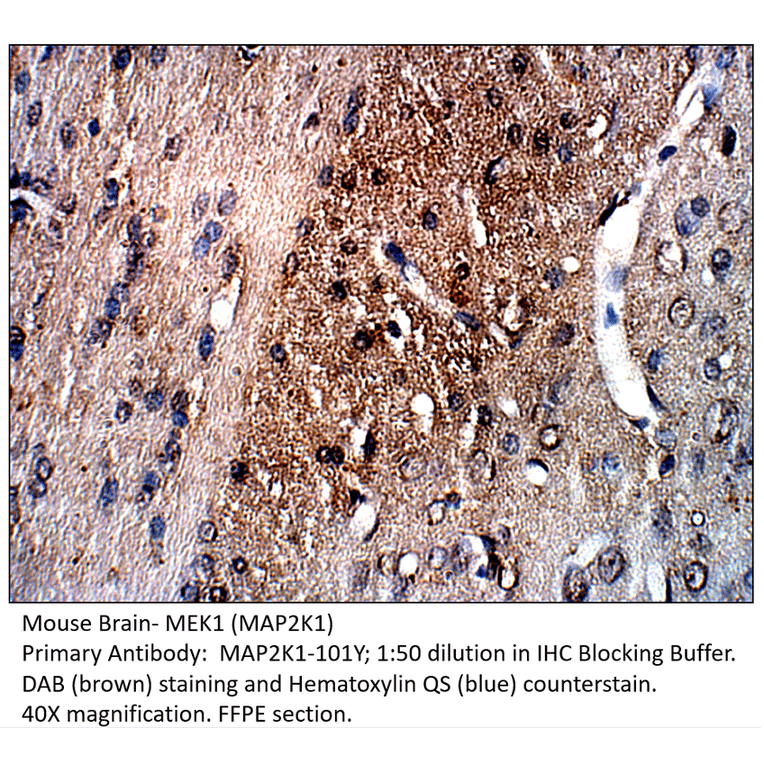 Anti-MAP2K1 Antibody from FabGennix (MAP2K1-101Y) - Antibodies.com