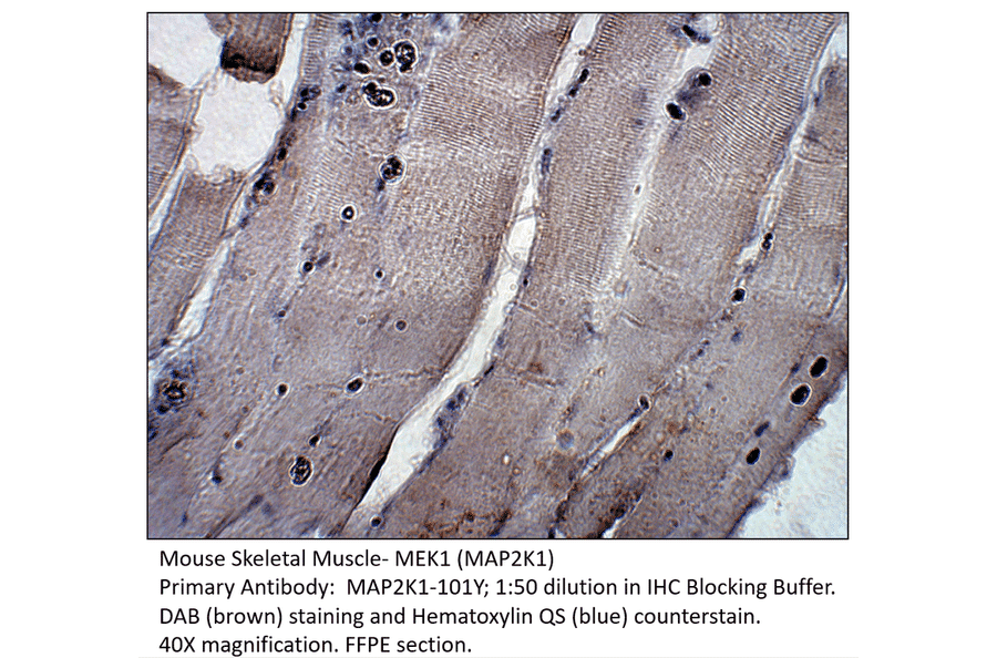 Anti-MAP2K1 Antibody from FabGennix (MAP2K1-101Y) - Antibodies.com