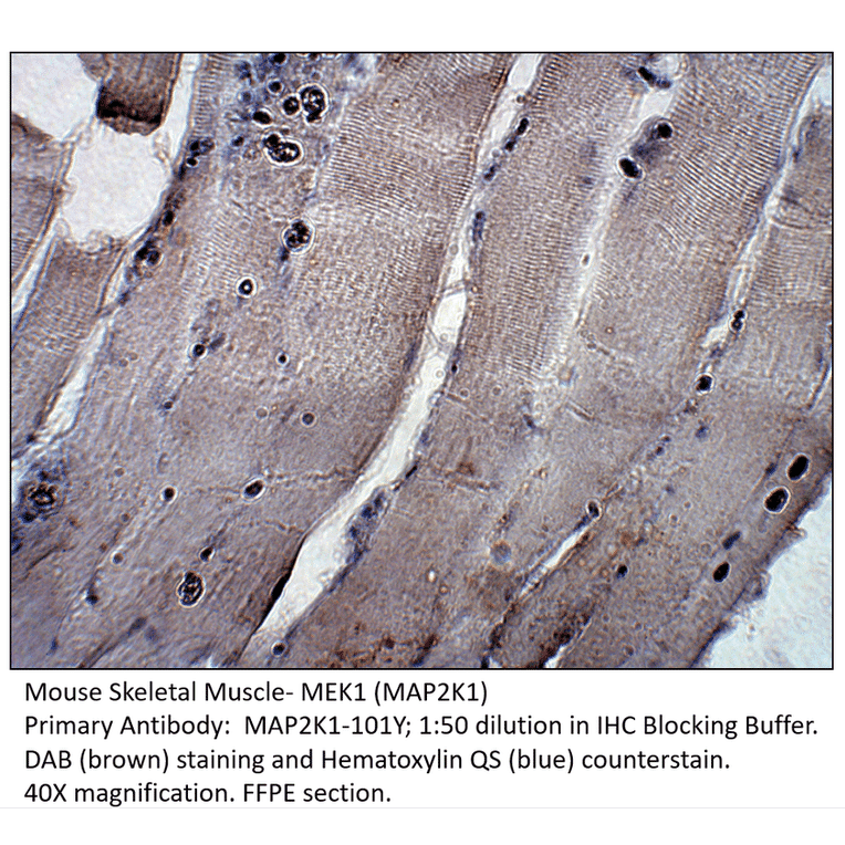 Anti-MAP2K1 Antibody from FabGennix (MAP2K1-101Y) - Antibodies.com