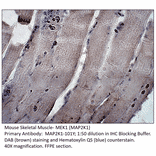 Anti-MAP2K1 Antibody from FabGennix (MAP2K1-101Y) - Antibodies.com