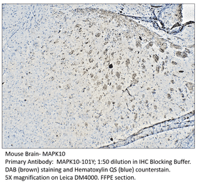 Anti-MAPK10 Antibody from FabGennix (MAPK10-101Y) - Antibodies.com