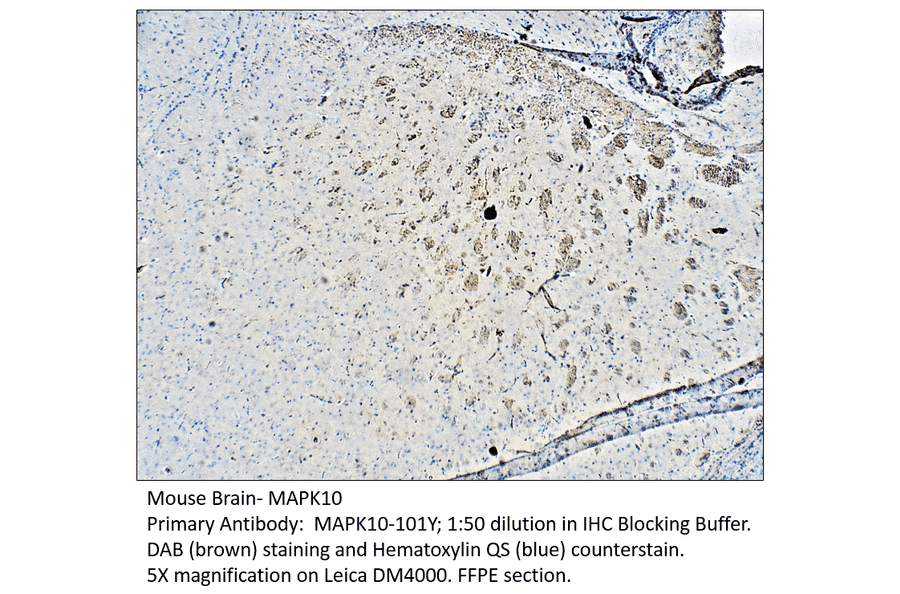 Anti-MAPK10 Antibody from FabGennix (MAPK10-101Y) - Antibodies.com