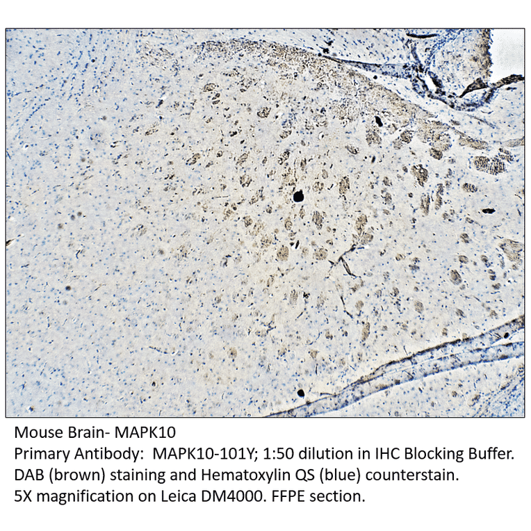 Anti-MAPK10 Antibody from FabGennix (MAPK10-101Y) - Antibodies.com