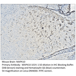 Anti-MAPK10 Antibody from FabGennix (MAPK10-101Y) - Antibodies.com