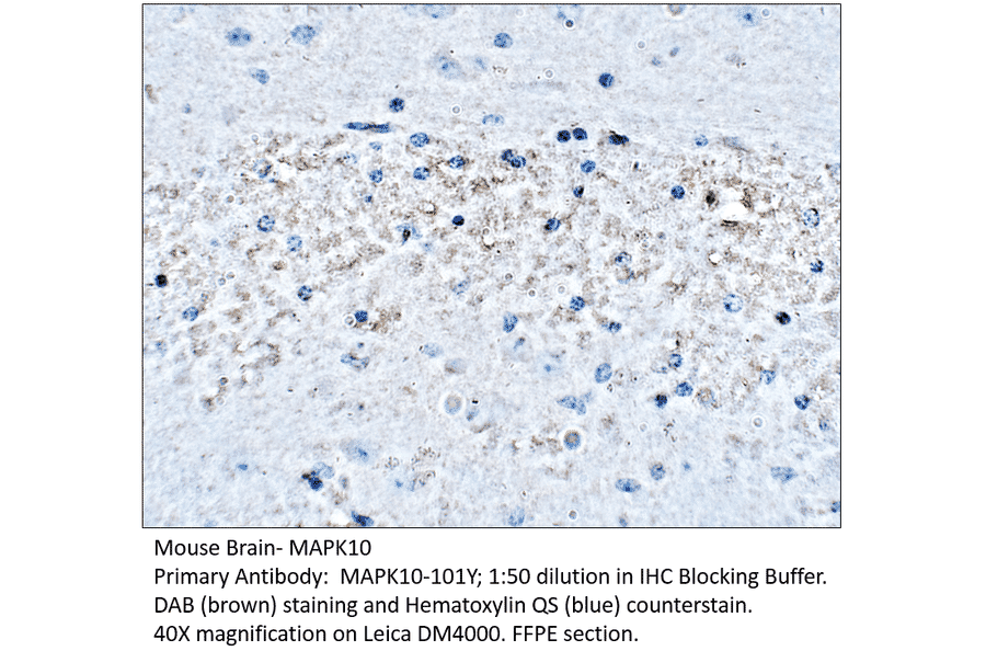 Anti-MAPK10 Antibody from FabGennix (MAPK10-101Y) - Antibodies.com