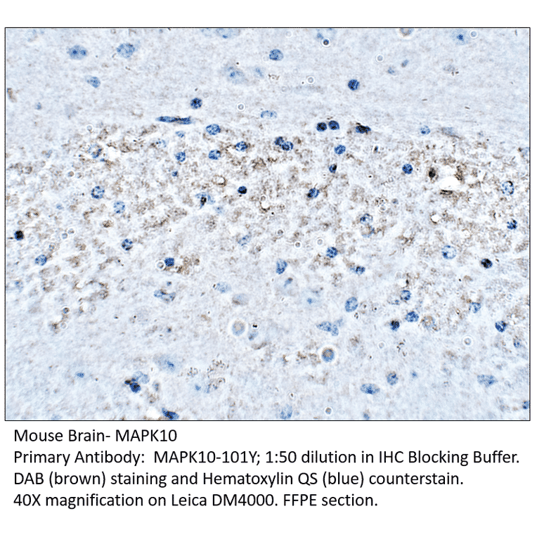 Anti-MAPK10 Antibody from FabGennix (MAPK10-101Y) - Antibodies.com