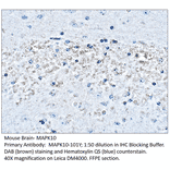 Anti-MAPK10 Antibody from FabGennix (MAPK10-101Y) - Antibodies.com