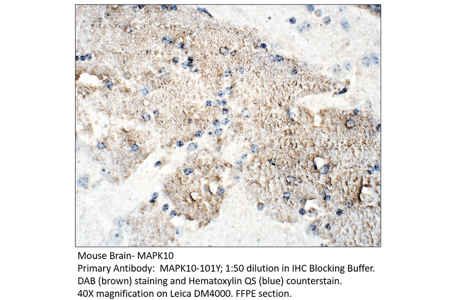 Anti-MAPK10 Antibody from FabGennix (MAPK10-101Y) - Antibodies.com