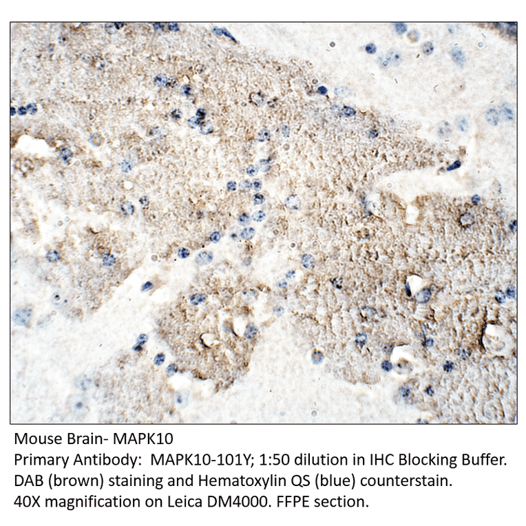 Anti-MAPK10 Antibody from FabGennix (MAPK10-101Y) - Antibodies.com
