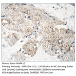 Anti-MAPK10 Antibody from FabGennix (MAPK10-101Y) - Antibodies.com