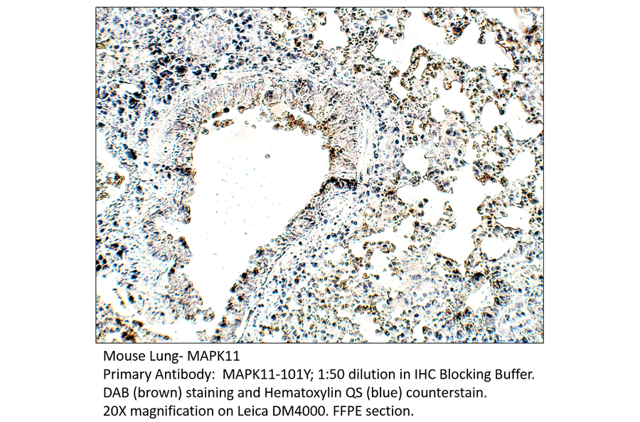 Anti-MAPK11 Antibody from FabGennix (MAPK11-101Y) - Antibodies.com