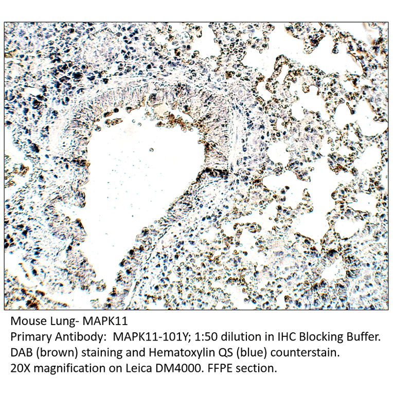 Anti-MAPK11 Antibody from FabGennix (MAPK11-101Y) - Antibodies.com
