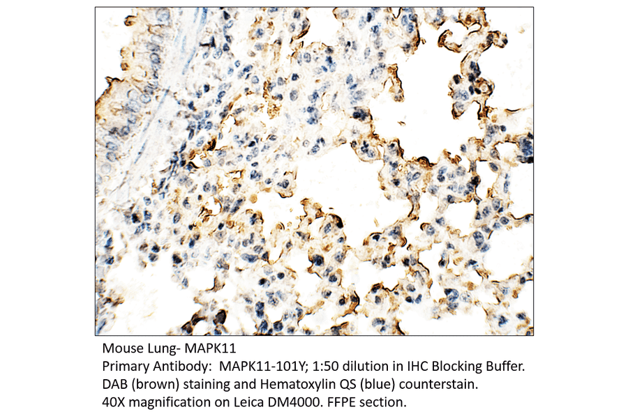 Anti-MAPK11 Antibody from FabGennix (MAPK11-101Y) - Antibodies.com