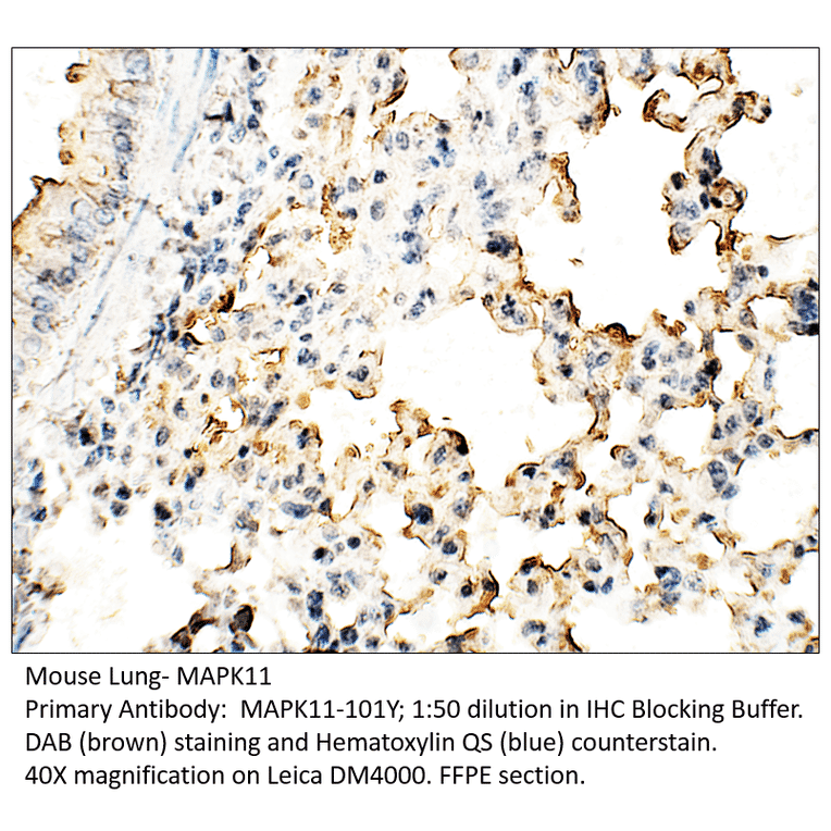 Anti-MAPK11 Antibody from FabGennix (MAPK11-101Y) - Antibodies.com