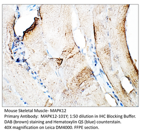 Anti-MAPK12 Antibody from FabGennix (MAPK12-101Y) - Antibodies.com