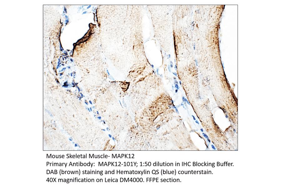 Anti-MAPK12 Antibody from FabGennix (MAPK12-101Y) - Antibodies.com