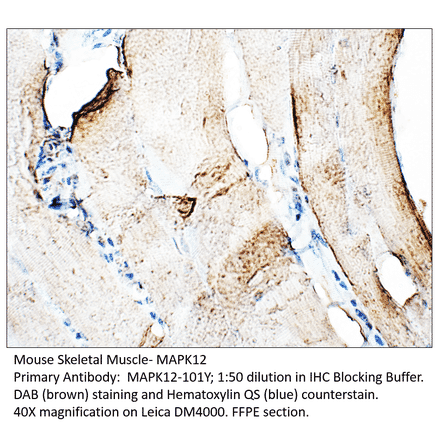 Anti-MAPK12 Antibody from FabGennix (MAPK12-101Y) - Antibodies.com