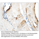 Anti-MAPK12 Antibody from FabGennix (MAPK12-101Y) - Antibodies.com