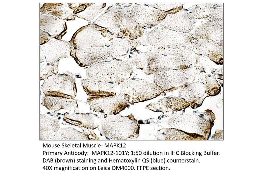 Anti-MAPK12 Antibody from FabGennix (MAPK12-101Y) - Antibodies.com