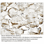 Anti-MAPK12 Antibody from FabGennix (MAPK12-101Y) - Antibodies.com