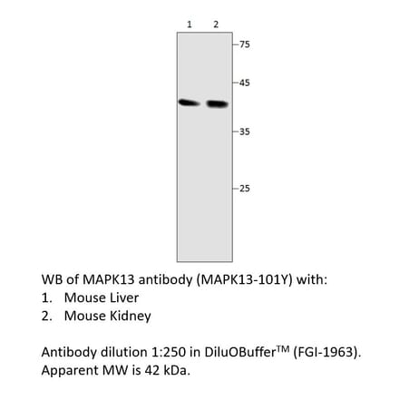 Anti-MAPK13 Antibody from FabGennix (MAPK13-101Y) - Antibodies.com