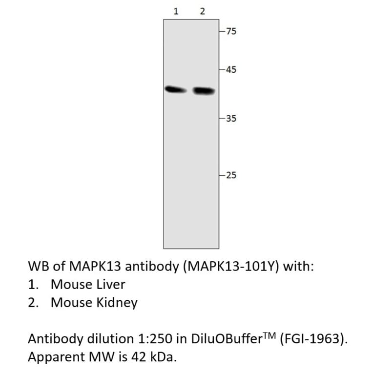 Anti-MAPK13 Antibody from FabGennix (MAPK13-101Y) - Antibodies.com