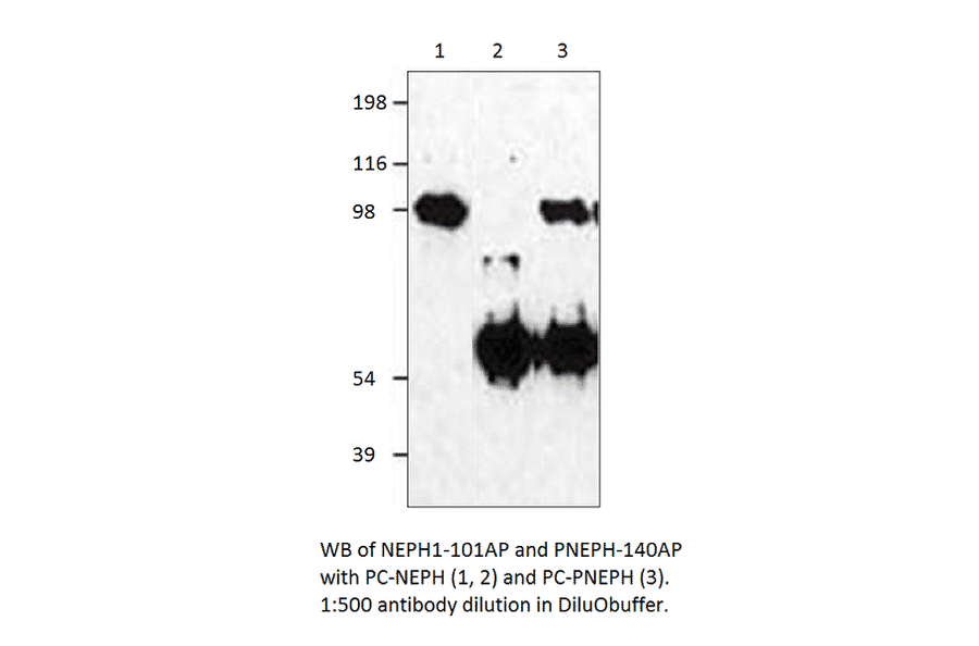 Anti-KIRREL Antibody from FabGennix (NEPH1-101AP) - Antibodies.com