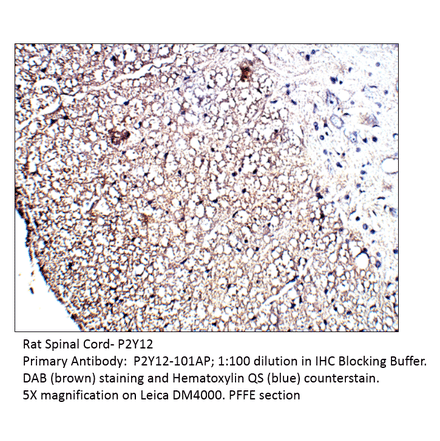 Anti-P2Y12 Antibody from FabGennix (P2Y12-1201AP) - Antibodies.com