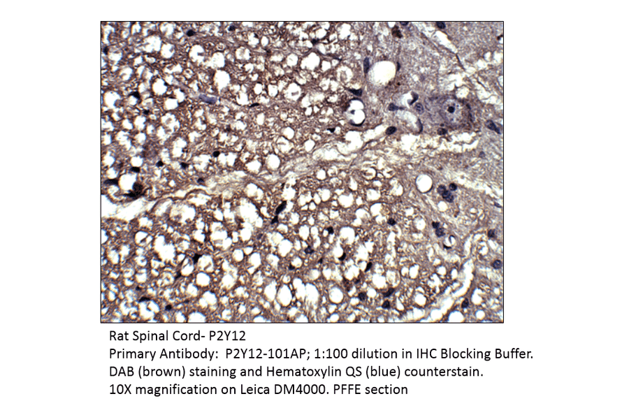 Anti-P2Y12 Antibody from FabGennix (P2Y12-1201AP) - Antibodies.com