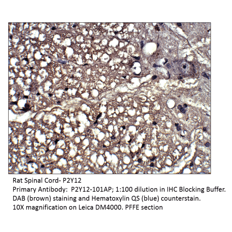 Anti-P2Y12 Antibody from FabGennix (P2Y12-1201AP) - Antibodies.com