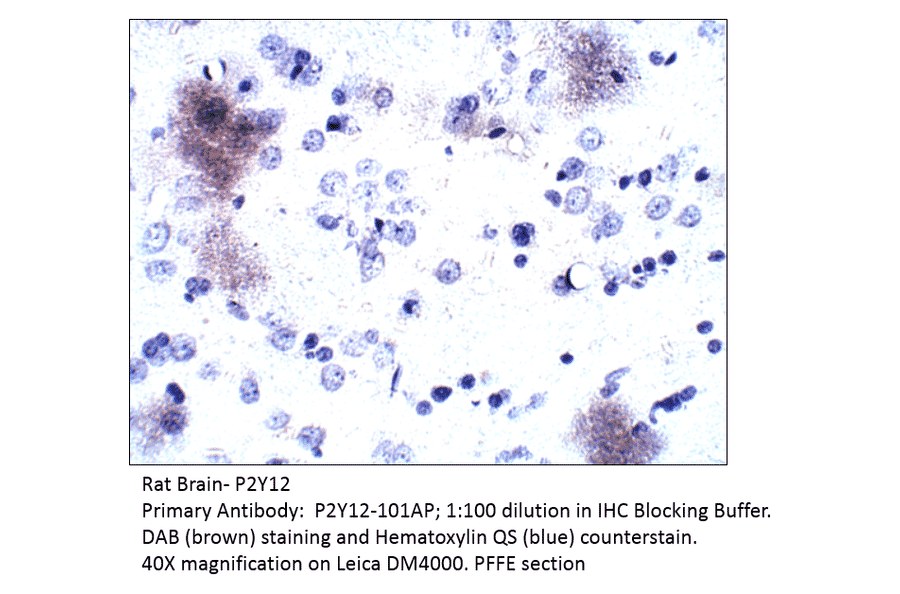 Anti-P2Y12 Antibody from FabGennix (P2Y12-1201AP) - Antibodies.com