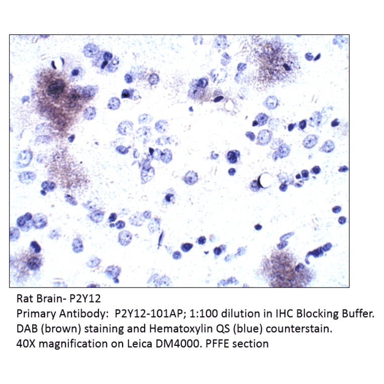 Anti-P2Y12 Antibody from FabGennix (P2Y12-1201AP) - Antibodies.com
