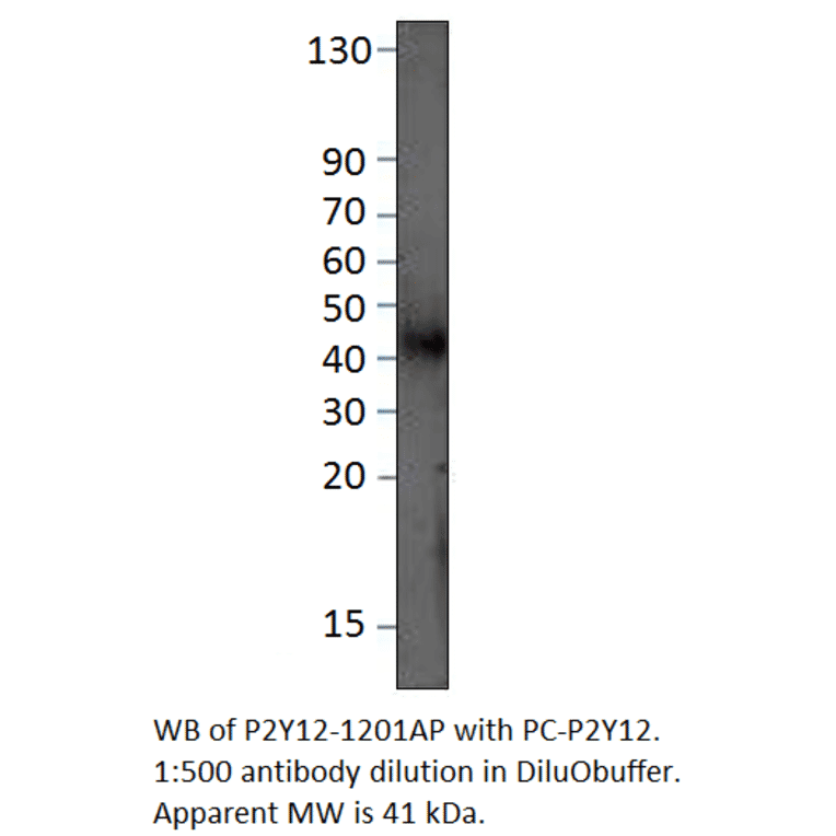 Anti-P2Y12 Antibody from FabGennix (P2Y12-1201AP) - Antibodies.com