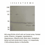 Anti-PDE10A Antibody from FabGennix (PD10A-101AP) - Antibodies.com